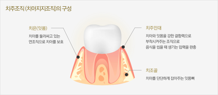 img_periodontal